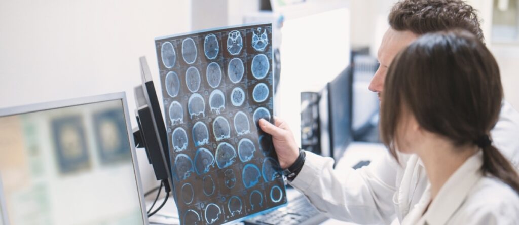 alzheimer santagostino imola