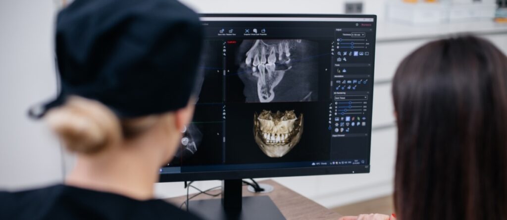 tac dentale santagostino imola