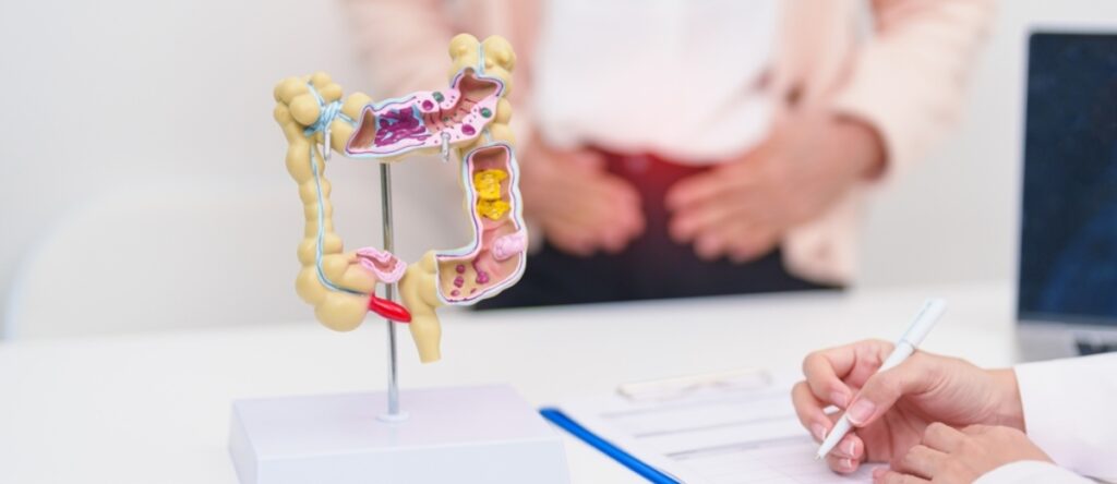 ulcera santagostino imola