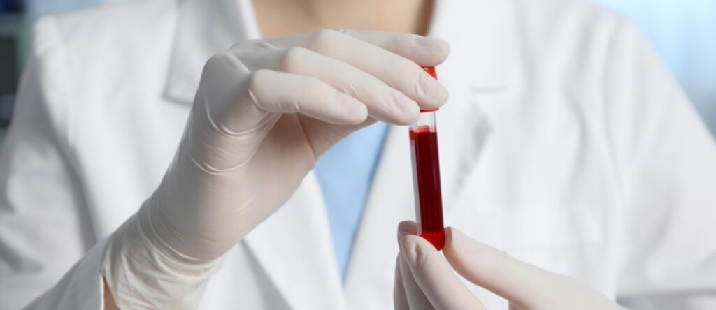 emocromo completo santagostino imola