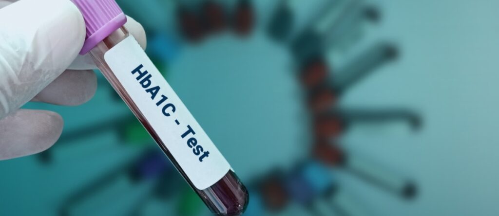 emoglobina glicata santagostino imola