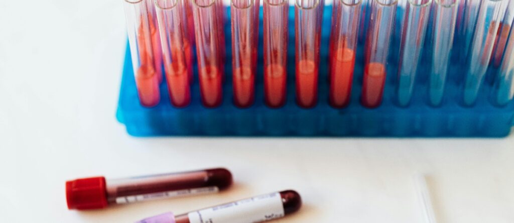 ferritina santagostino imola