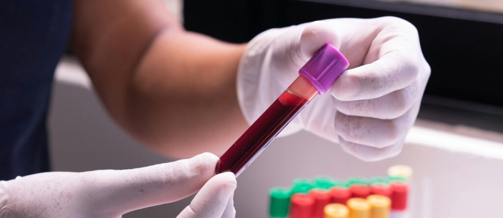 iperprolattinemia santagostino imola