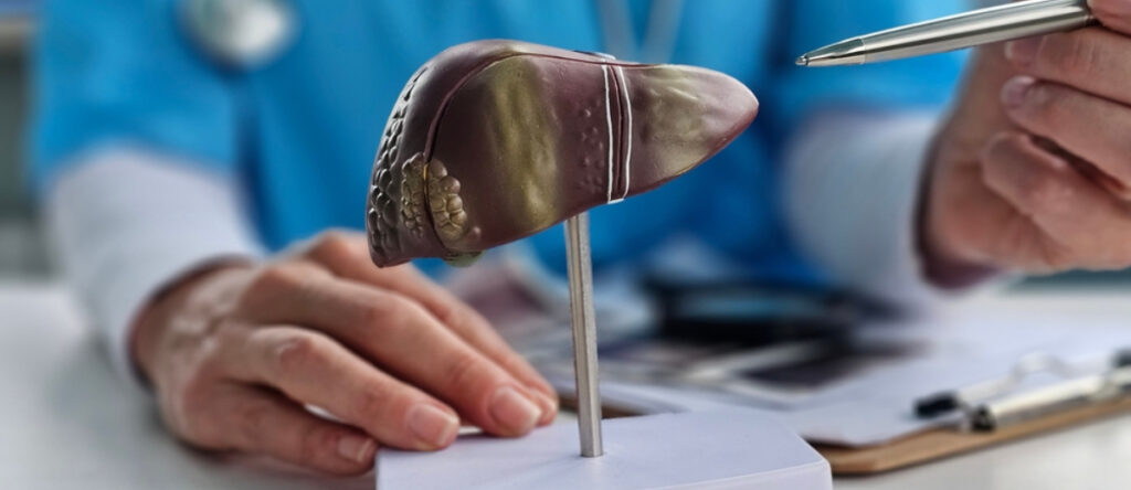 steatosi epatica santagostino imola