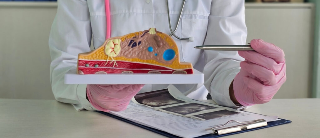 tumore al seno imola