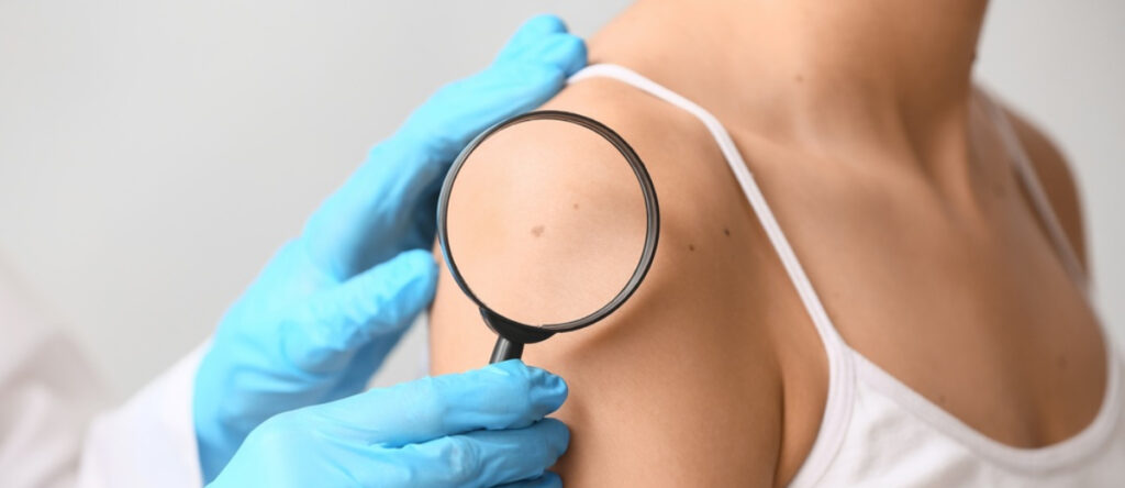 visita dermatologica imola