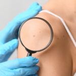 visita dermatologica imola
