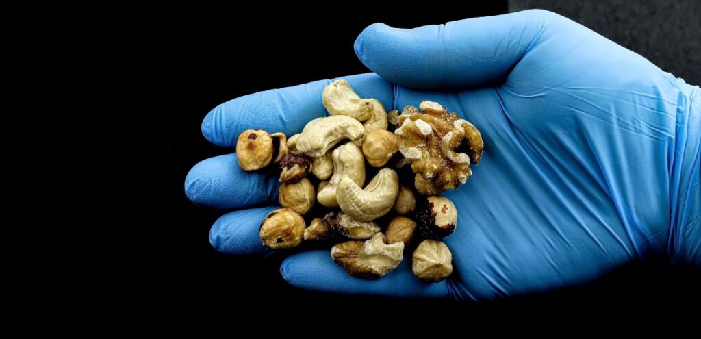 allergie alimentari test