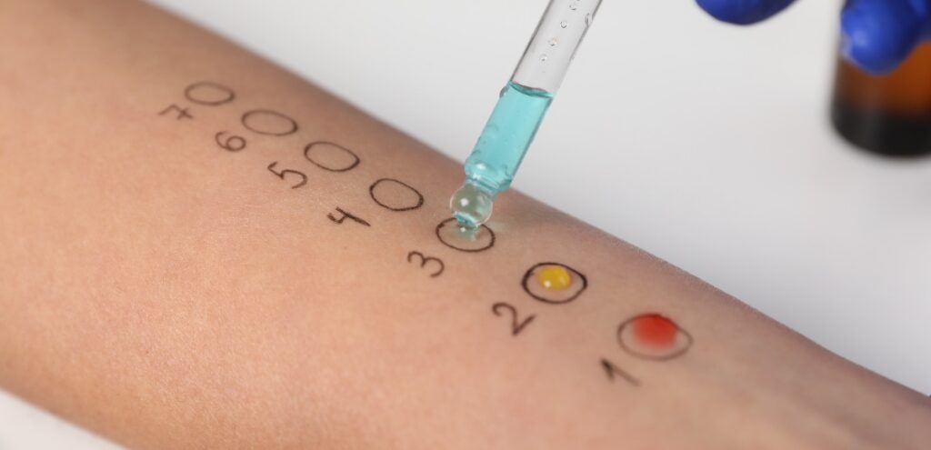 prick test imola