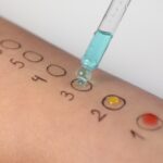 prick test imola